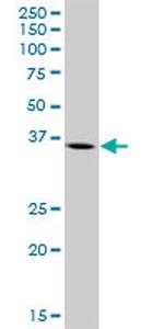 ARG2 Antibody in Western Blot (WB)