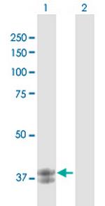 ARG2 Antibody in Western Blot (WB)