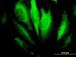 RHOA Antibody in Immunocytochemistry (ICC/IF)