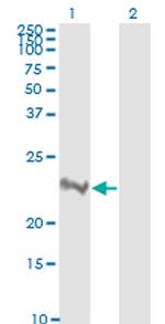 RHOA Antibody in Western Blot (WB)