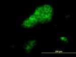 RHOA Antibody in Immunocytochemistry (ICC/IF)