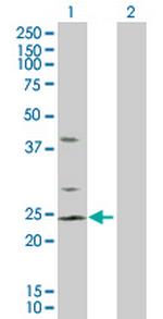 RHOC Antibody in Western Blot (WB)