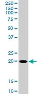 RHOC Antibody in Western Blot (WB)