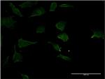 RHOC Antibody in Immunocytochemistry (ICC/IF)