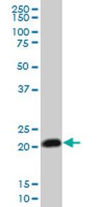 RHOC Antibody in Western Blot (WB)