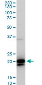 RHOC Antibody in Western Blot (WB)