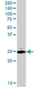 ARHGDIA Antibody in Western Blot (WB)