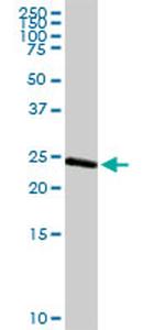 ARHGDIA Antibody in Western Blot (WB)