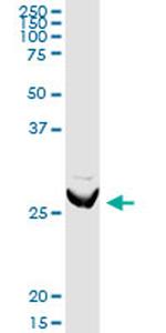 ARHGDIA Antibody in Western Blot (WB)