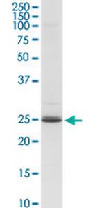 ARHGDIA Antibody in Western Blot (WB)