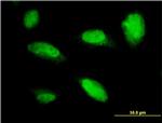 PHOX2A Antibody in Immunocytochemistry (ICC/IF)