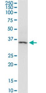 ARRB2 Antibody in Western Blot (WB)