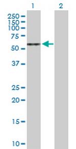 ARSA Antibody in Western Blot (WB)