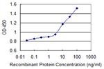 ARSB Antibody in ELISA (ELISA)