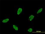 ASCL1 Antibody in Immunocytochemistry (ICC/IF)