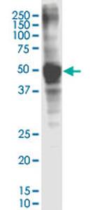 ASGR1 Antibody in Western Blot (WB)