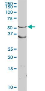 ASL Antibody in Western Blot (WB)