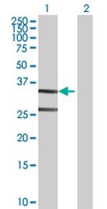 ASPA Antibody in Western Blot (WB)