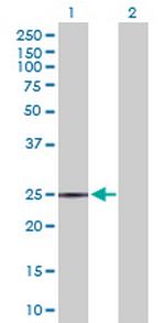 ASPH Antibody in Western Blot (WB)