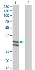 SERPINC1 Antibody in Western Blot (WB)