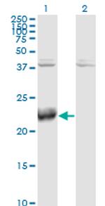 ATF3 Antibody in Western Blot (WB)