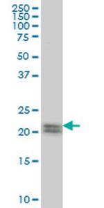 ATF3 Antibody in Western Blot (WB)