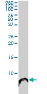 ATOX1 Antibody in Western Blot (WB)