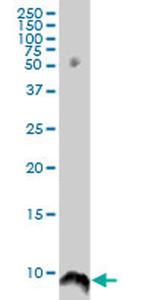 ATOX1 Antibody in Western Blot (WB)