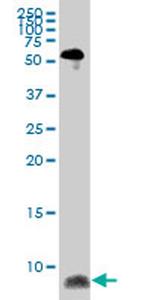 ATOX1 Antibody in Western Blot (WB)