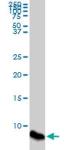 ATOX1 Antibody in Western Blot (WB)