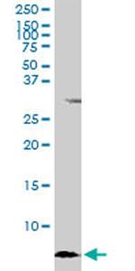 ATOX1 Antibody in Western Blot (WB)