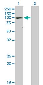 ATP2A1 Antibody in Western Blot (WB)