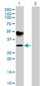 ATP4B Antibody in Western Blot (WB)