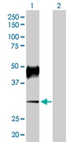ATP4B Antibody in Western Blot (WB)