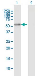 ALDH7A1 Antibody in Western Blot (WB)