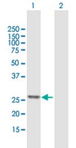 ATP5F1 Antibody in Western Blot (WB)