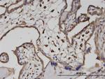 ATP6V1A Antibody in Immunohistochemistry (Paraffin) (IHC (P))