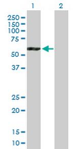 ATP6V1B2 Antibody in Western Blot (WB)