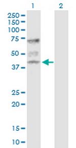 ATP6V1C1 Antibody in Western Blot (WB)