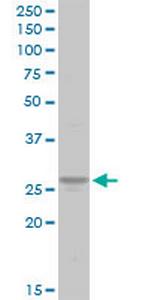 ATP6V1E1 Antibody in Western Blot (WB)