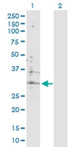 ATP6V0B Antibody in Western Blot (WB)