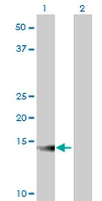 ATP6V1G2 Antibody in Western Blot (WB)