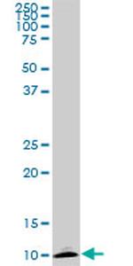 ATP6V1G2 Antibody in Western Blot (WB)