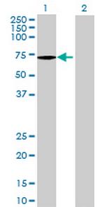 ATP6AP1 Antibody in Western Blot (WB)