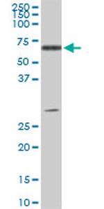 ATP6AP1 Antibody in Western Blot (WB)