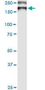 ATP7B Antibody in Western Blot (WB)