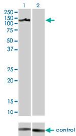 AXL Antibody in Western Blot (WB)