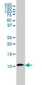 B2M Antibody in Western Blot (WB)