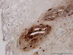 B2M Antibody in Immunohistochemistry (Paraffin) (IHC (P))