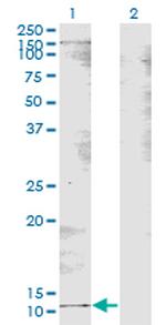 B2M Antibody in Western Blot (WB)